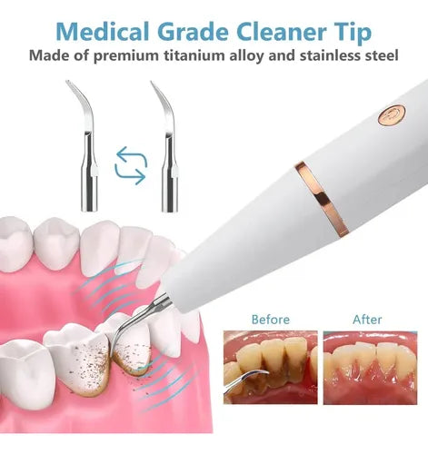 Eliminador De Placa Para Dientes Ultrasonico